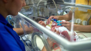 3600 Fälle: So viele werden schweizweit jährlich auf der Neonatologie behandelt.